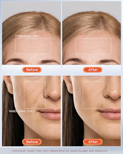 Baguette anti-âge Claréa à luminothérapie rouge – Appareil anti-âge 4-en-1 pour le visage et le cou