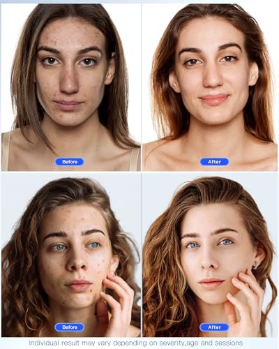 Masque Facial Anti-Âge à Lumière Rouge Claréa – 7 Modes, Appareil de Soin de la Peau